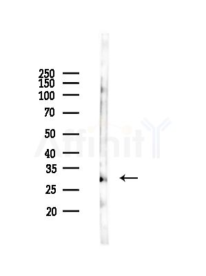Cytochrome c-type Heme Lyase Antibody - Western blot analysis of lysates from Rat lung, using Cytochrome c-type Heme Lyase Antibody at 1/1000 dilution.