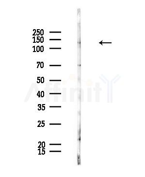 CDCA2 Antibody - Western blot analysis of lysates from Rat brain, using CDCA2 Antibody at 1/1000 dilution.