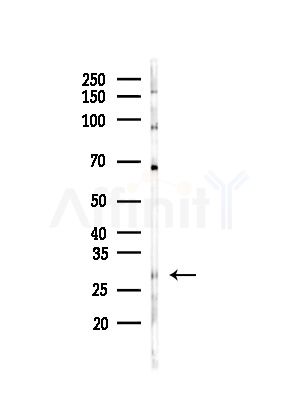 CDCA3 Antibody - Western blot analysis of lysates from MDA-MB-231 cells(heat-shock,45min treatment), using CDCA3 Antibody at 1/1000 dilution.