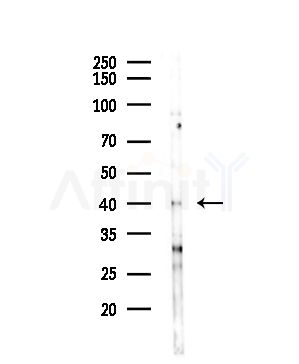 CDCA7 Antibody - Western blot analysis of lysates from COLO205 cells(UV,30min treatment), using CDCA7 Antibody at 1/1000 dilution.