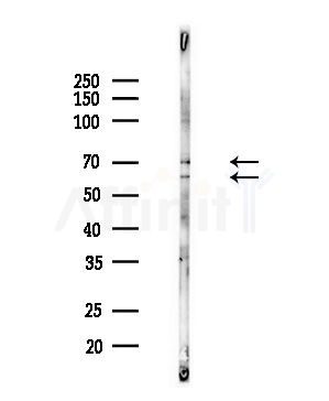 CDKAL Antibody - Western blot analysis of lysates from PC12 cells(LPS,4h treatment), using CDKAL Antibody at 1/1000 dilution.
