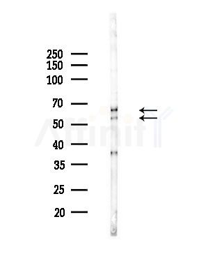 CDKAL Antibody - Western blot analysis of lysates from Hela cells(starvation,24h treatment), using CDKAL Antibody at 1/1000 dilution.