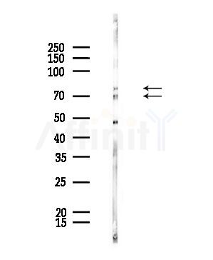 CDKAL Antibody - Western blot analysis of lysates from Rat brain, using CDKAL Antibody at 1/1000 dilution.