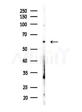 CDK5RAP3 Antibody - Western blot analysis of lysates from MDA-MB-231 cells(heat-shock,45min treatment), using CDK5RAP3 Antibody at 1/1000 dilution.