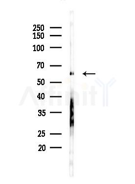 CDK5RAP3 Antibody - Western blot analysis of lysates from LoVo cells(heat-shock,45min treatment), using CDK5RAP3 Antibody at 1/1000 dilution.