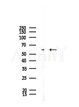 CDK5RAP3 Antibody - Western blot analysis of lysates from Rat liver, using CDK5RAP3 Antibody at 1/1000 dilution.
