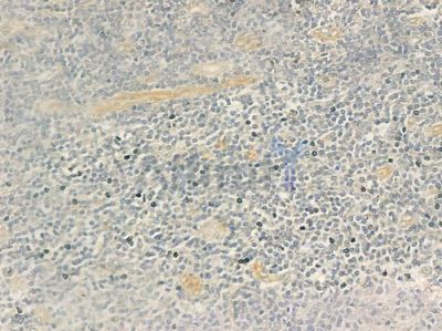 Collagen I  alpha 2 Antibody - DF3549 at 1/100 staining human normal tonsil tissue by IHC-P.