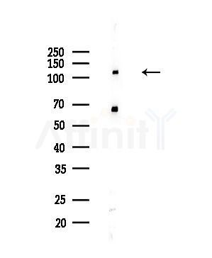 Collagen VI alpha 2 Antibody - Western blot analysis of lysates from PC12 cells(LPS,4h treatment), using Collagen VI alpha 2 Antibody at 1/1000 dilution.