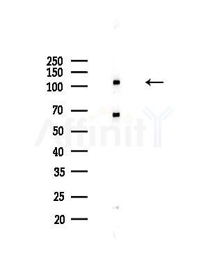 Collagen VI alpha 2 Antibody - Western blot analysis of lysates from Hela cells(starvation,24h treatment), using Collagen VI alpha 2 Antibody at 1/1000 dilution.