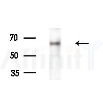 Collagen XXV  alpha 1 Antibody - Western blot analysis of extracts from HepG2 cells(heat-shock,45min treatment), using Collagen XXV  alpha 1 Antibody at 1/1000 dilution.