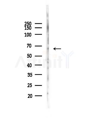 Collagen XXV  alpha 1 Antibody - Western blot analysis of lysates from HepG2 cells(heat-shock,45min treatment), using Collagen XXV  alpha 1 Antibody at 1/1000 dilution.