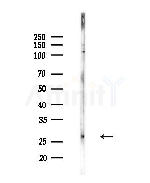 COX6C Antibody - Western blot analysis of lysates from PC12 cells(LPS,4h treatment), using COX6C Antibody at 1/1000 dilution.