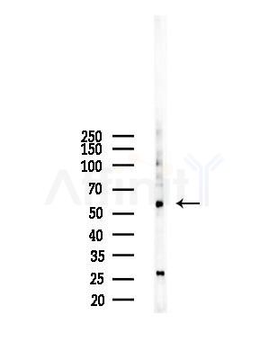 Cytochrome P450 1A1/2 Antibody - Western blot analysis of lysates from RAW264.