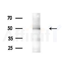 Cytochrome P450 24A1 Antibody - Western blot analysis of extracts from A549 cells(heat-shock treatment), using Cytochrome P450 24A1 Antibody at 1/1000 dilution.