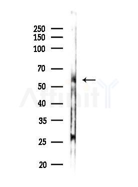 Cytochrome P450 26C1 Antibody - Western blot analysis of lysates from COLO205 cells(UV,30min treatment), using Cytochrome P450 26C1 Antibody at 1/1000 dilution.