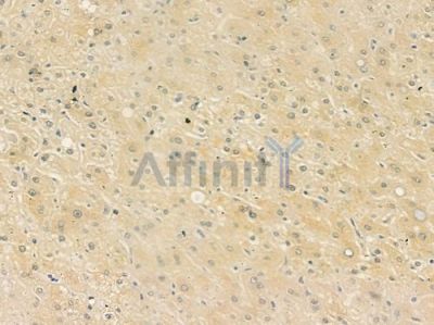 Cytochrome P450 2J2 Antibody - DF3579 at 1/100 staining human normal liver tissue by IHC-P.