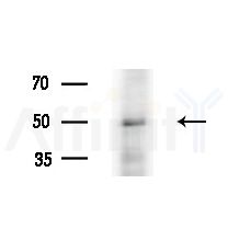 Cytochrome P450 3A43 Antibody - Western blot analysis of lysates from Rat liver, using Cytochrome P450 3A43 Antibody at 1/1000 dilution.