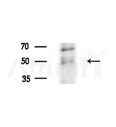 Cytochrome P450 3A43 Antibody - Western blot analysis of lysates from HepG2 cells(UV treatment), using Cytochrome P450 3A43 Antibody at 1/1000 dilution.