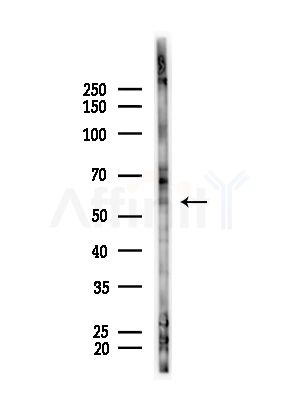 Cytochrome P450 3A43 Antibody - Western blot analysis of lysates from B16F10-LUC cells(starvation,24h treatment), using Cytochrome P450 3A43 Antibody at 1/1000 dilution.