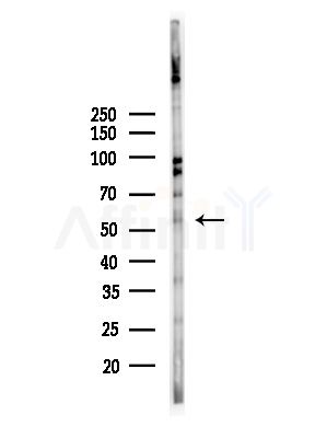 Cytochrome P450 3A43 Antibody - Western blot analysis of lysates from HepG2 cells(UV,30min treatment), using Cytochrome P450 3A43 Antibody at 1/1000 dilution.