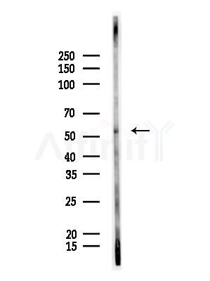 Cytochrome P450 3A43 Antibody - Western blot analysis of lysates from Rat liver, using Cytochrome P450 3A43 Antibody at 1/1000 dilution.