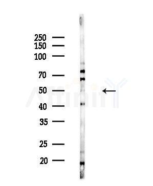 Cytochrome P450 3A4/5 Antibody - Western blot analysis of lysates from PC12 cells(LPS,4h treatment), using Cytochrome P450 3A4/5 Antibody at 1/1000 dilution.
