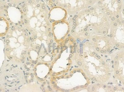 Cytochrome P450 4B1 Antibody - DF3588 at 1/100 staining human normal kidney tissue by IHC-P.