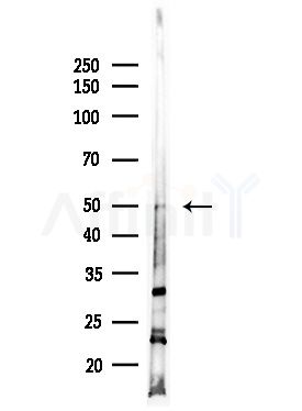 Cytochrome P450 4X1 Antibody - Western blot analysis of lysates from Hela cells(starvation,24h treatment), using Cytochrome P450 4X1 Antibody at 1/1000 dilution.