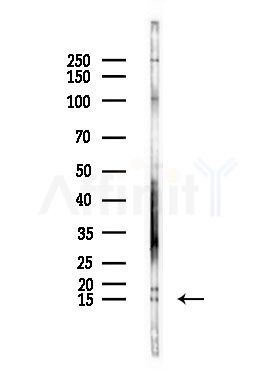 CYTL1 Antibody - Western blot analysis of lysates from LoVo cells(heat-shock,45min treatment), using CYTL1 Antibody at 1/1000 dilution.