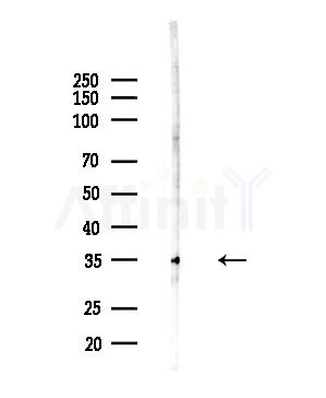 FGF23 Antibody - Western blot analysis of lysates from PC12 cells(LPS,4h treatment), using FGF23 Antibody at 1/1000 dilution.