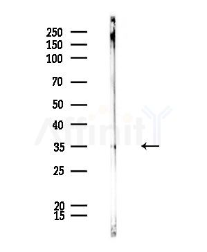 FGF23 Antibody - Western blot analysis of lysates from Rat lung, using FGF23 Antibody at 1/1000 dilution.