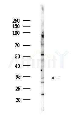 IL20RB Antibody - Western blot analysis of lysates from B16F10-LUC cells(heat-shock,45min treatment), using IL20RB Antibody at 1/1000 dilution.