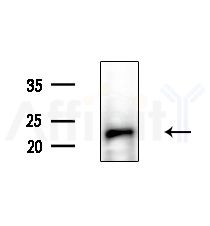 BCL2L2 Antibody - Western blot analysis of extracts from Rat liver, using BCL2L2 Antibody at 1/1000 dilution.