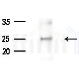 CIDEB Antibody - Western blot analysis of extracts from HepG2 cells(heat-shock,45min treatment), using CIDEB Antibody at 1/1000 dilution.