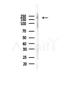 DCC Antibody - Western blot analysis of lysates from COLO205 cells(heat-shock,45min treatment), using DCC Antibody at 1/1000 dilution.