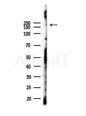 MLH3 Antibody - Western blot analysis of lysates from LoVo cells(heat-shock,45min treatment), using MLH3 Antibody at 1/1000 dilution.