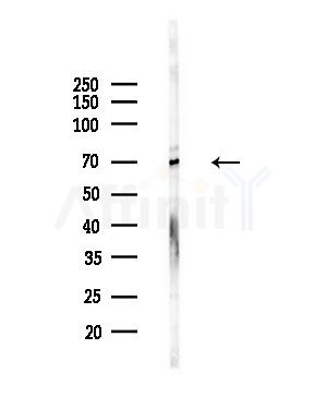 T3JAM Antibody - Western blot analysis of lysates from Hela cells(starvation,24h treatment), using T3JAM Antibody at 1/1000 dilution.