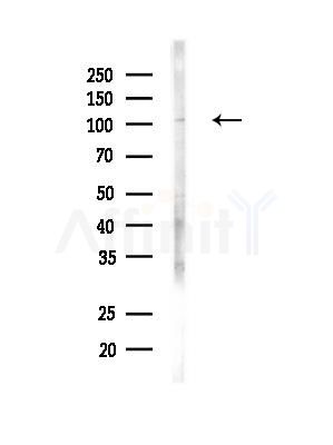EFTUD2 Antibody - Western blot analysis of lysates from MDA-MB-231 cells(heat-shock, 45min treatment), using EFTUD2 Antibody at 1/1000 dilution.