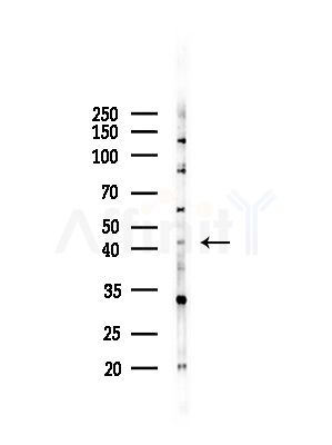 AGPAT3 Antibody - Western blot analysis of lysates from COLO205 cells(heat-shock,45min treatment), using AGPAT3 Antibody at 1/1000 dilution.