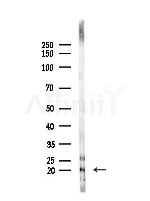 MRPS12 Antibody - Western blot analysis of lysates from B16F10-LUC cells(starvation,24h treatment), using MRPS12 Antibody at 1/1000 dilution.