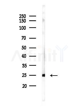 MRPS7 Antibody - Western blot analysis of lysates from LoVo cells(heat-shock,45min treatment), using MRPS7 Antibody at 1/1000 dilution.