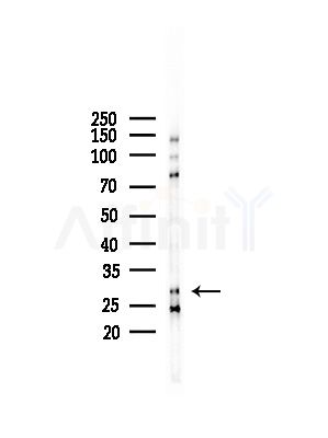 MRPL10 Antibody - Western blot analysis of lysates from LoVo cells(heat-shock,45min treatment), using MRPL10 Antibody at 1/1000 dilution.