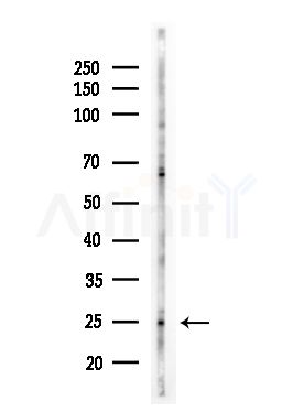 MRPL11 Antibody - Western blot analysis of lysates from HUVEC cells(UV,30min treatment), using MRPL11 Antibody at 1/1000 dilution.