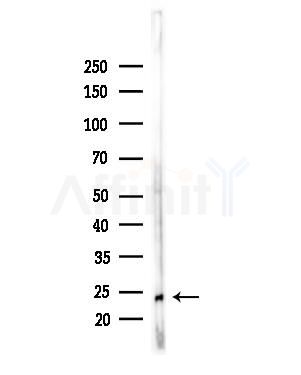 MRPL13 Antibody - Western blot analysis of lysates from MCF7 cells(heat-shock,45min treatment), using MRPL13 Antibody at 1/1000 dilution.