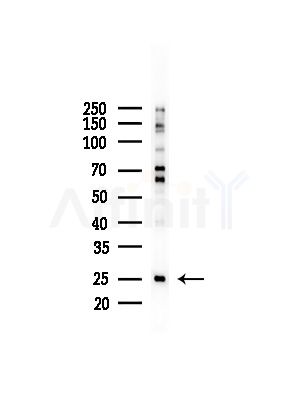 MRPL16 Antibody - Western blot analysis of lysates from LoVo cells(heat-shock,45min treatment), using MRPL16 Antibody at 1/1000 dilution.