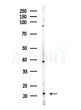 MRPL18 Antibody - Western blot analysis of lysates from MDA-MB-231 cells(heat-shock,45min treatment), using MRPL18 Antibody at 1/1000 dilution.