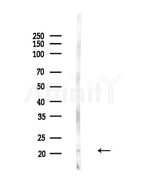 MRPL20 Antibody - Western blot analysis of lysates from PC12 cells(LPS,4h treatment), using MRPL20 Antibody at 1/1000 dilution.