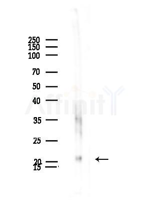 MRPL21 Antibody - Western blot analysis of lysates from Hela cells(heat-shock,45min treatment), using MRPL21 Antibody at 1/1000 dilution.