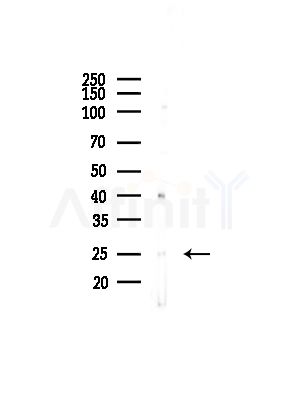 MRPL32 Antibody - Western blot analysis of lysates from COLO205 cells(UV,30min treatment), using MRPL32 Antibody at 1/1000 dilution.