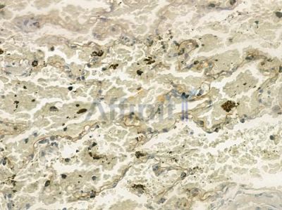 MRPL9 Antibody - DF3675 at 1/100 staining human normal lung tissue by IHC-P.